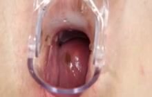 Gaping her pussy with speculum